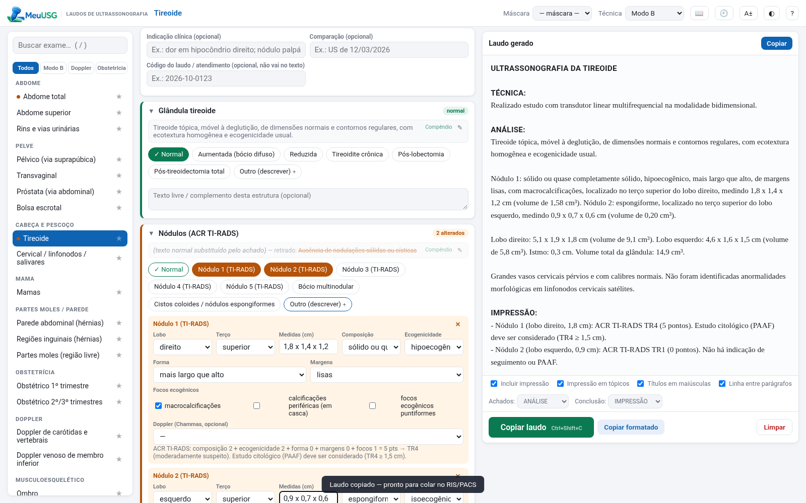 Meu USG — tireoide